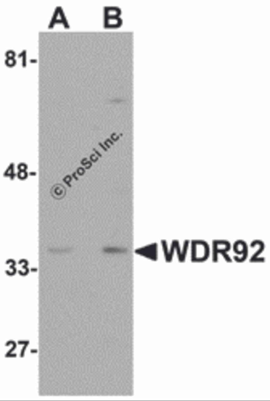 Western blot analysis of WDR92 in human kidney tissue lysate with WDR92 antibody at (A) 1 and (B) 2 &#956;g/mL.