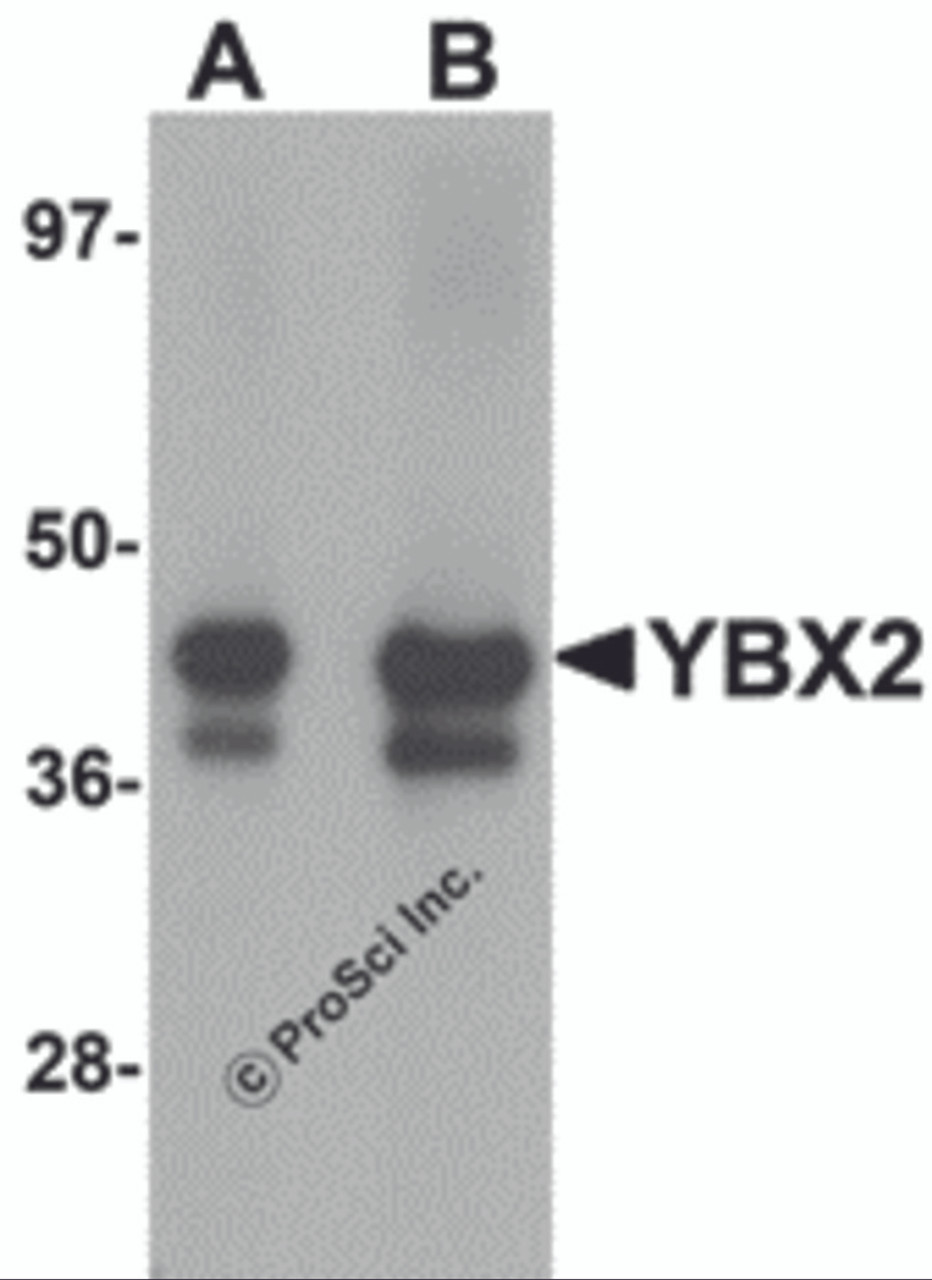Western blot analysis of YBX2 in human testis tissue lysate with YBX2 antibody at (A) 1 and (B) 2 &#956;g/mL.