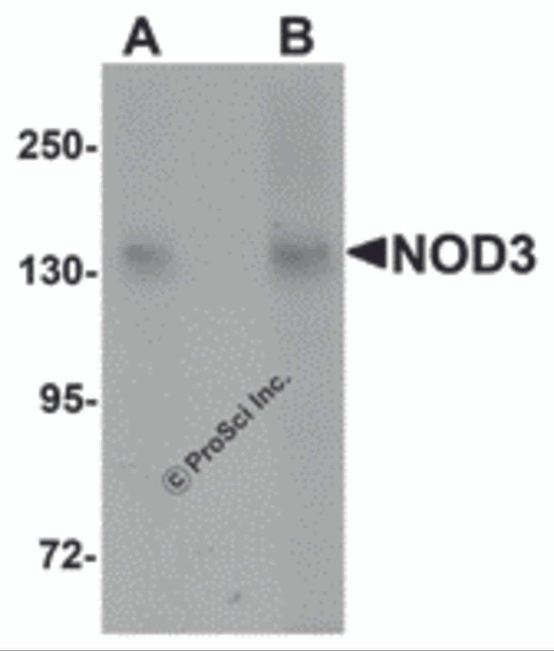 Western blot analysis of NOD3 in 3T3 cell lysate with NOD3 antibody at (A) 1 and (B) 2 &#956;g/mL.