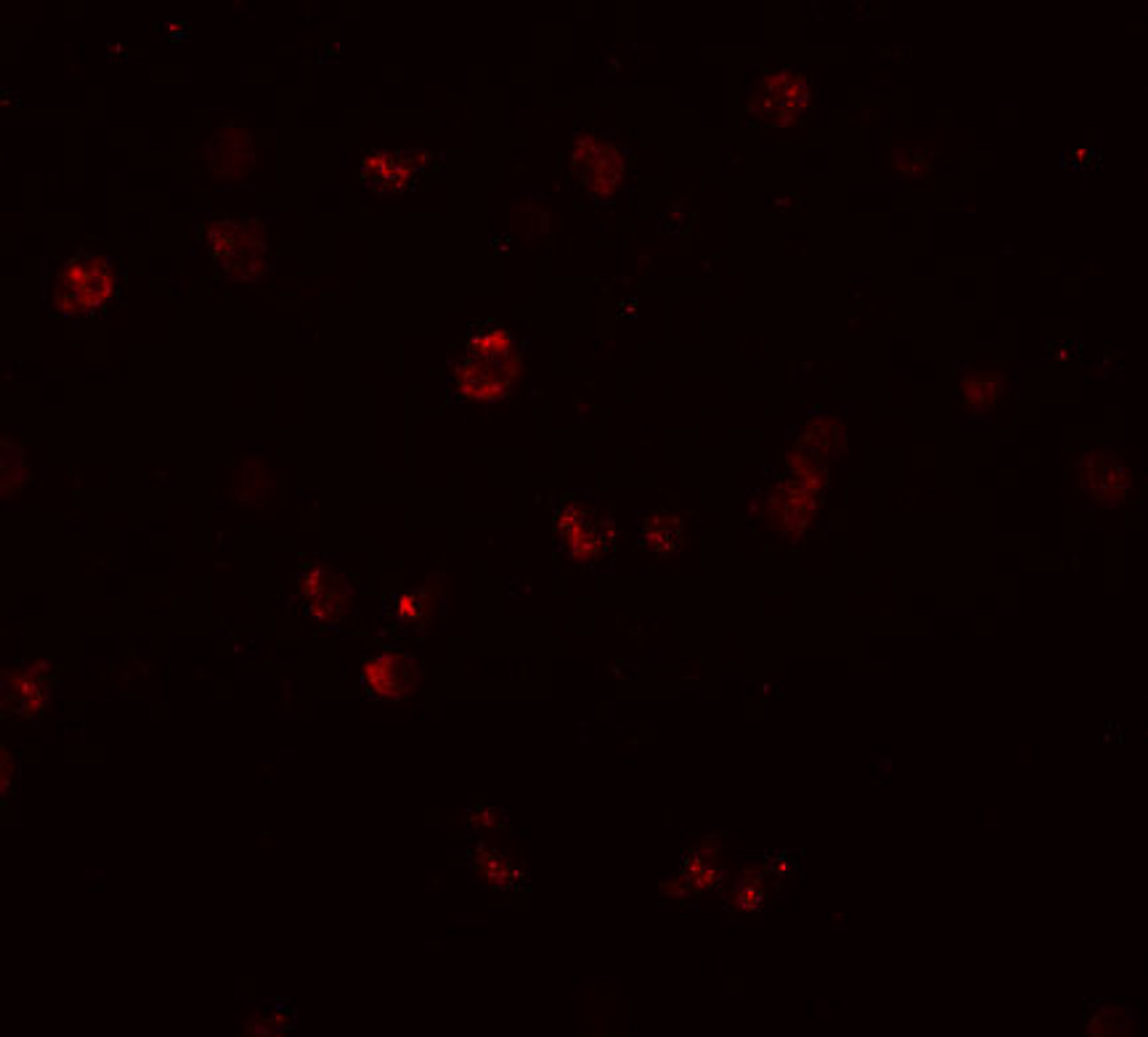 Immunofluorescence of NOD3 in Jurkat cells with NOD3 antibody at 20 ug/mL.