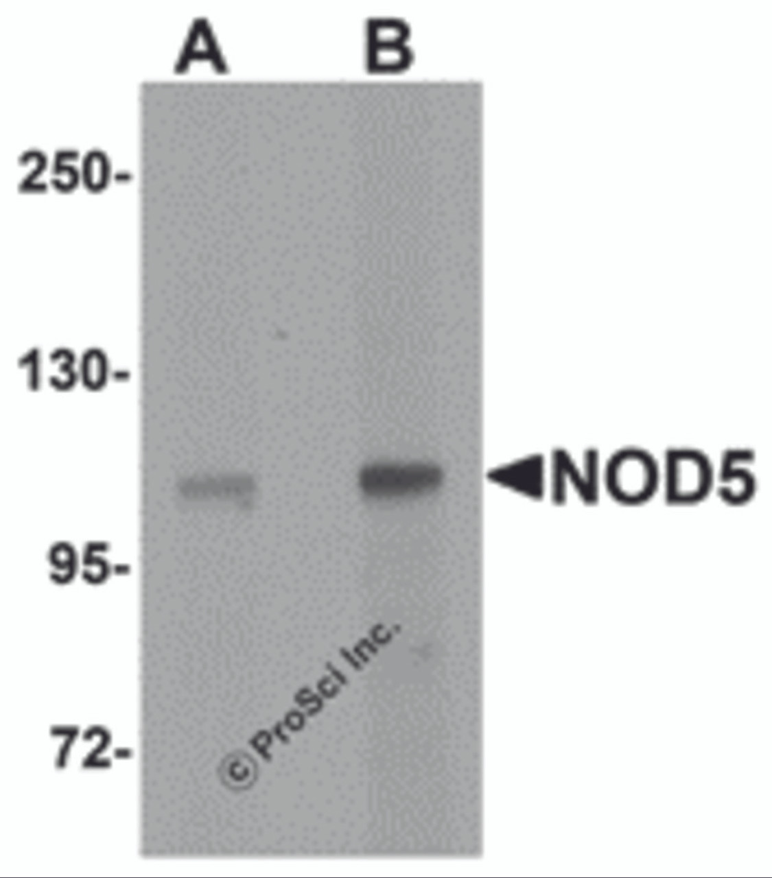 Western blot analysis of NOD5 in rat spleen tissue cell lysate with NOD5 antibody at (A) 1 and (B) 2 &#956;g/mL.