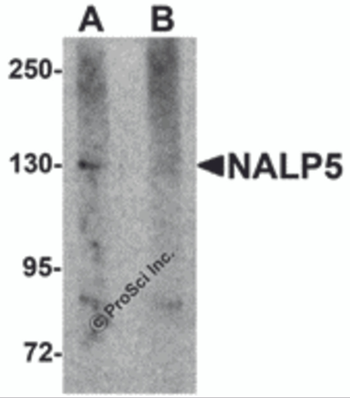Western blot analysis of NALP5 in mouse brain tissue lysate with NALP5 antibody at 1 &#956;g/mL in (A) the absence and (B) the presence of blocking peptide.