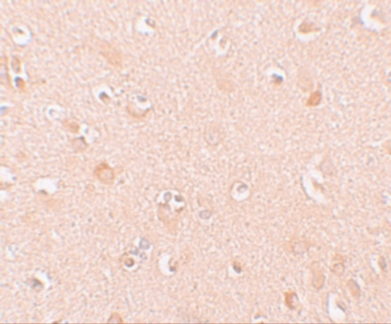 Immunohistochemistry of NALP5 in human brain tissue with NALP5 antibody at 10 ug/mL.