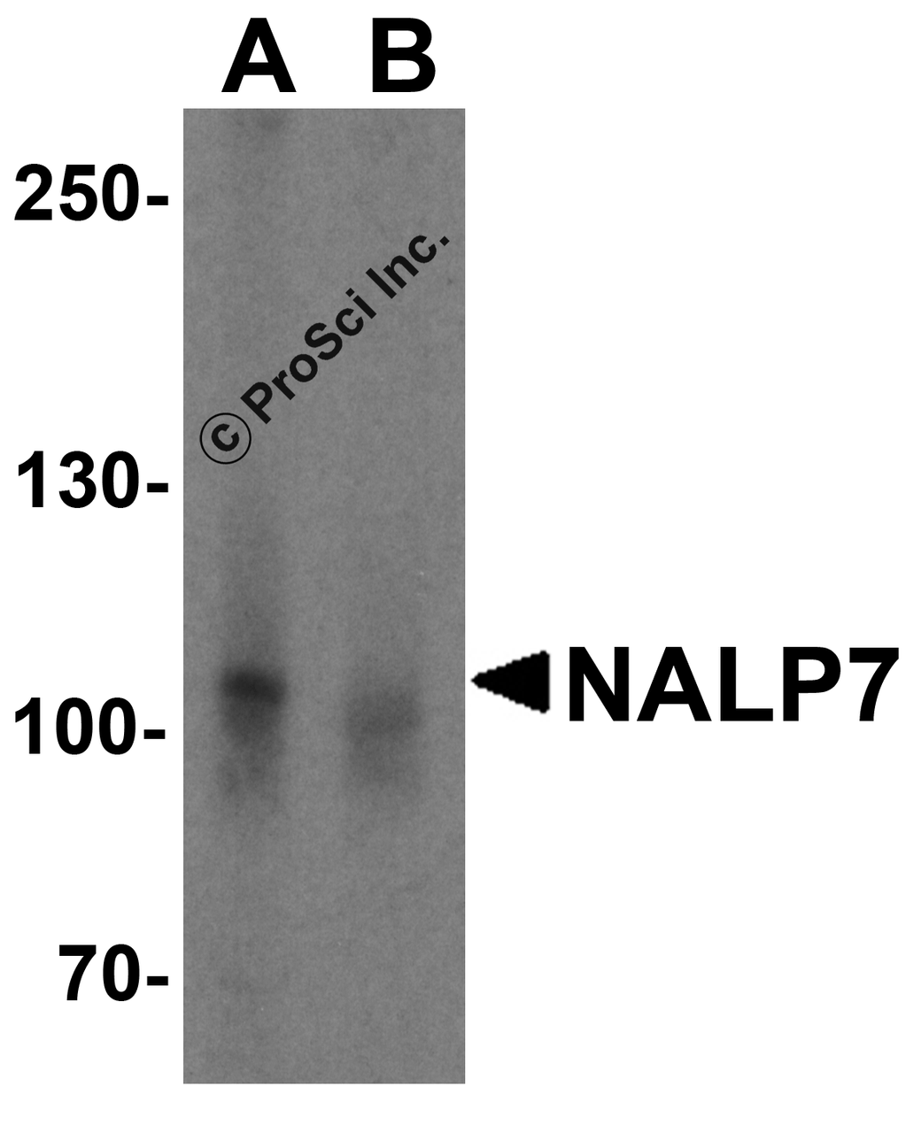 Western blot analysis of NALP7 in K562 cell lysate with NALP7 antibody at 2 &#956;g/mL in (A) the absence and (B) the presence of blocking peptide.