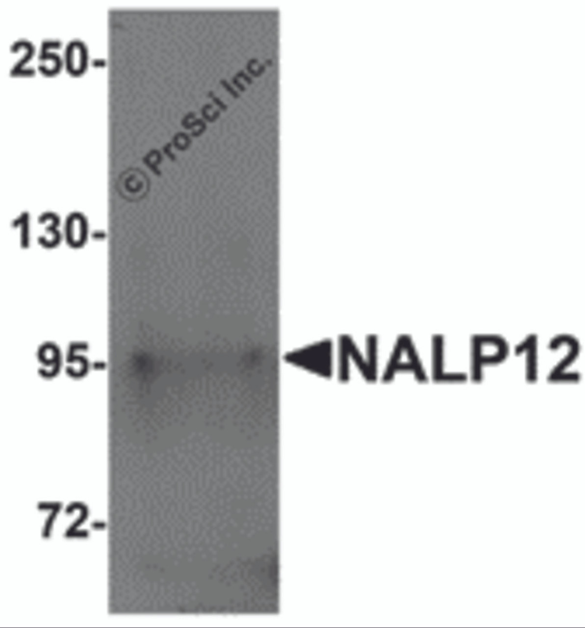 Western blot analysis of NALP12 in human brain tissue lysate with NALP12 antibody at 1 &#956;g/mL.