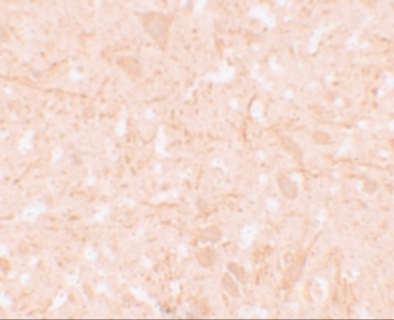 Immunohistochemistry of NALP12 in human brain tissue with NALP12 antibody at 5 ug/mL.