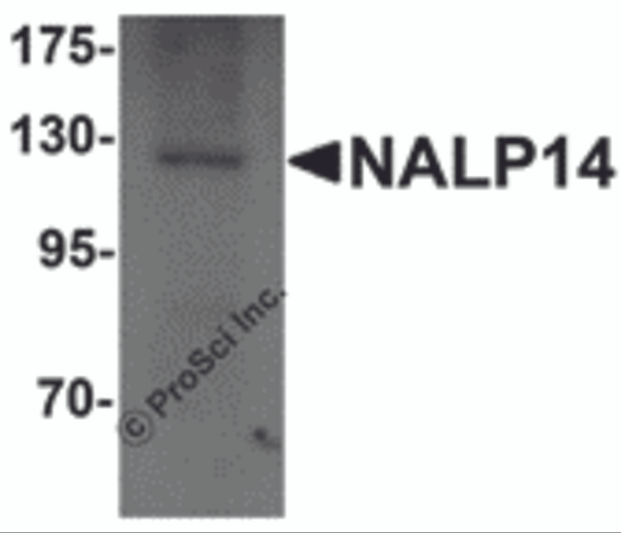 Western blot analysis of NALP14 in rat brain tissue lysate with NALP14 antibody at 1 &#956;g/mL.