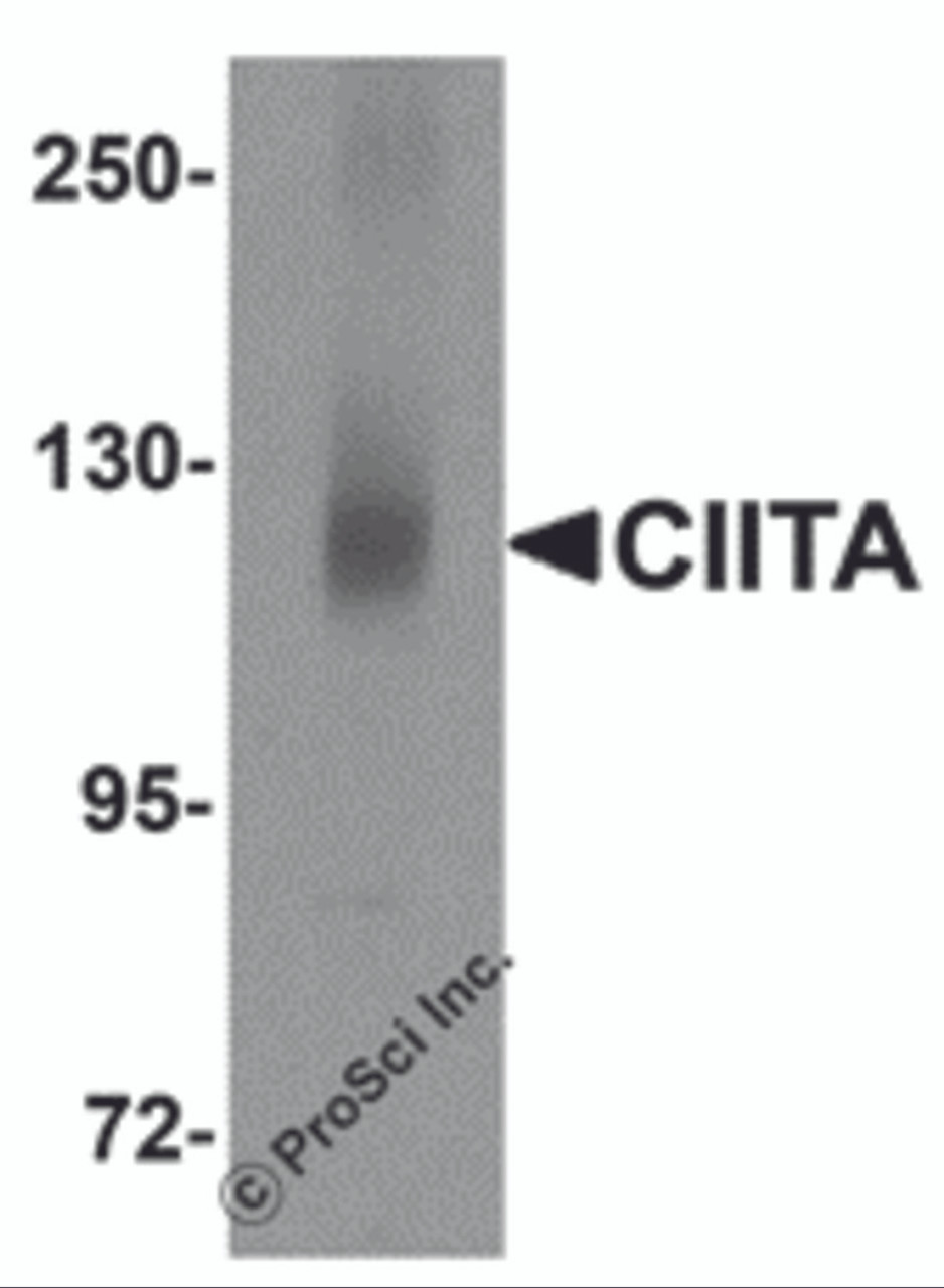 Western blot analysis of CIITA in rat brain tissue lysate with CIITA antibody at 1 &#956;g/mL.
