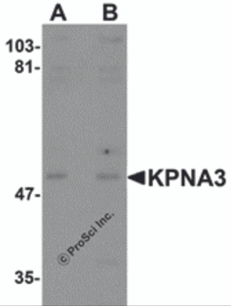 Western blot analysis of KPNA3 in EL4 cell lysate with KPNA3 antibody at (A) 1 and (B) 2 &#956;g/mL.
