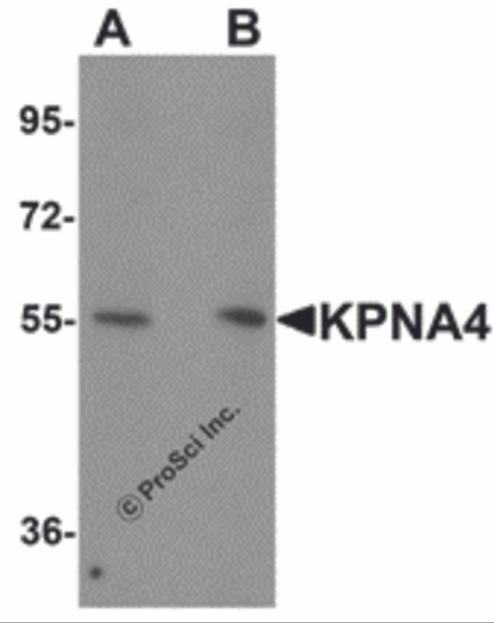 Western blot analysis of KPNA4 in HeLa cell lysate with KPNA4 antibody at (A) 0.5 and (B) 1 &#956;g/mL.