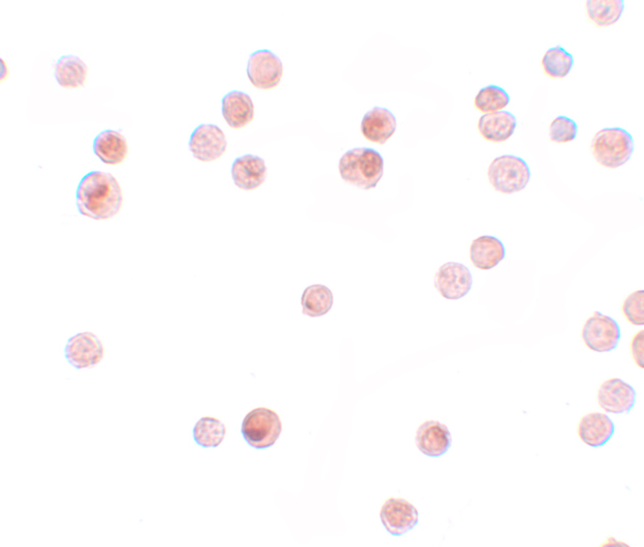 Immunocytochemistry of KPNA4 in HeLa cells with KPNA4 antibody at 2.5 ug/mL.