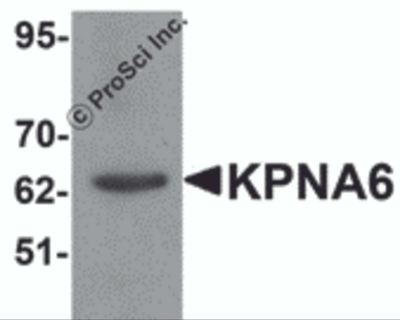 Western blot analysis of KPNA6 in 293 cell lysate with KPNA6 antibody at 1 &#956;g/mL.