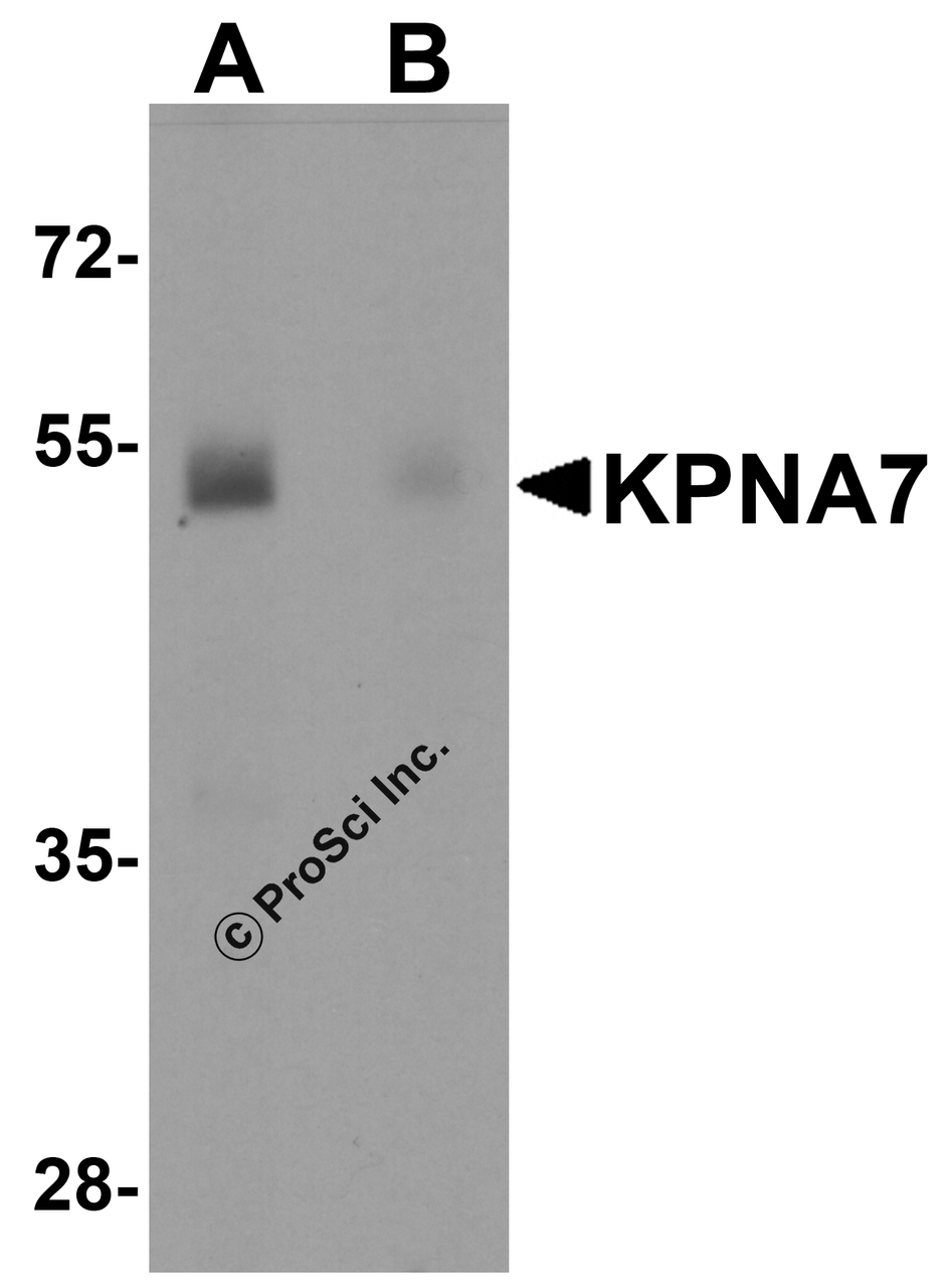 Western blot analysis of KPNA7 in human spleen with KPNA7 antibody at 1 &#956;g/ml in (A) the absence and (B) the presence of blocking peptide.