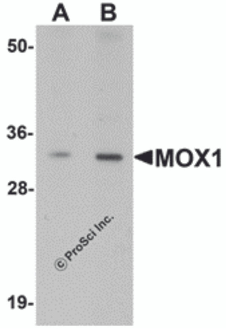 Western blot analysis of MOX1 in human liver tissue lysate with MOX1 antibody at (A) 1 and (B) 2 &#956;g/mL.