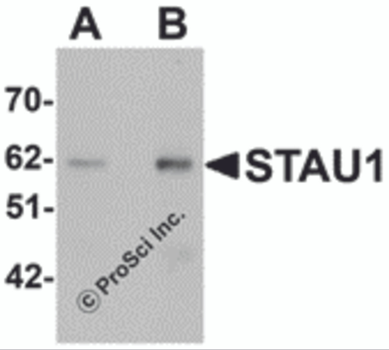 Western blot analysis of STAU1 in rat brain tissue lysate with STAU1 antibody at (A) 1 and (B) 2 &#956;g/mL.