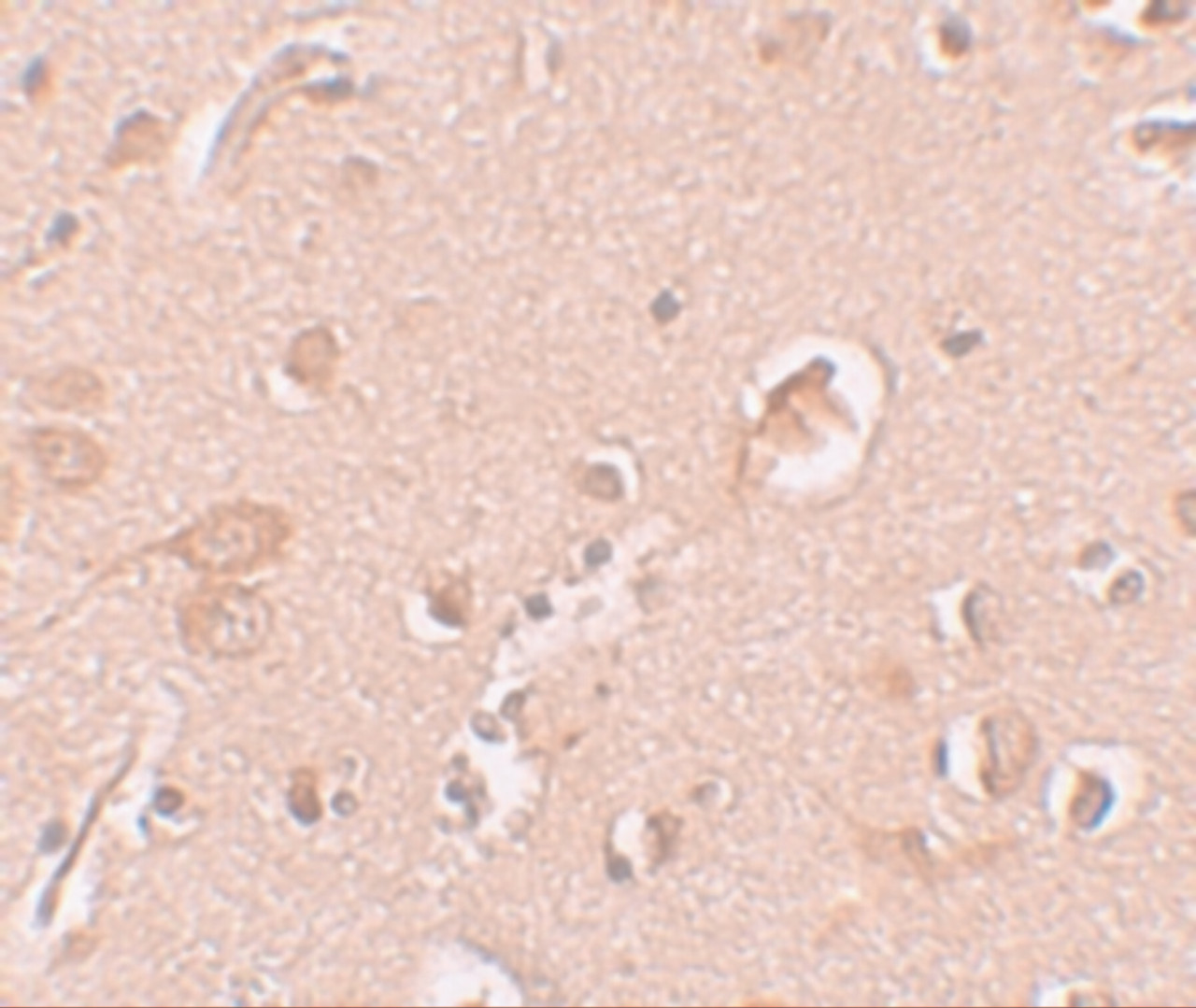 Immunohistochemistry of STAU1 in human brain tissue with STAU1 antibody at 10 ug/mL.