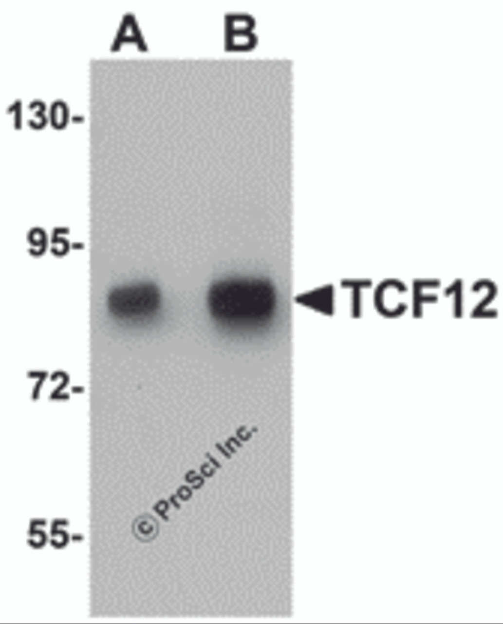 Western blot analysis of TCF12 in HeLa cell lysate with TCF12 antibody at (A) 0.5 and (B) 1 &#956;g/mL.