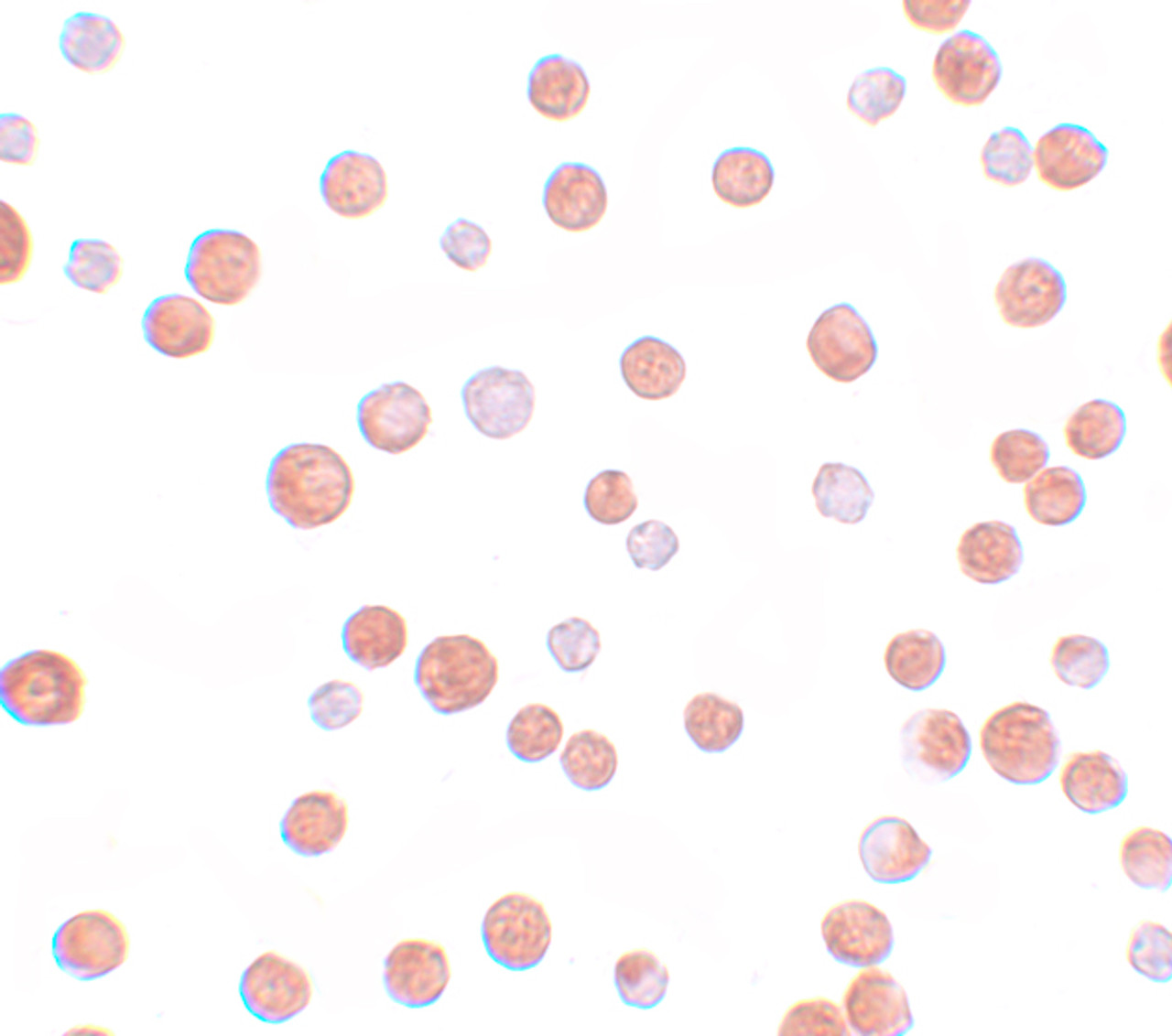 Immunocytochemistry of TCF12 in HeLa cells with TCF12 antibody at 10 ug/mL.