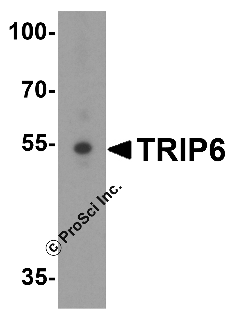 Western blot analysis of TRIP6 in A431 cell lysate with TRIP6 antibody at 1 &#956;g/mL.