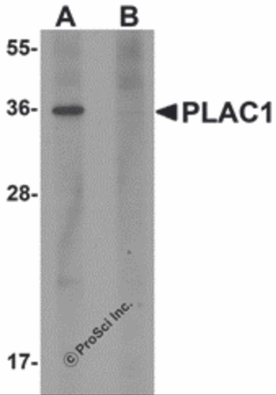 Western blot analysis of PLAC1 in human placenta tissue lysate with PLAC1 antibody at 1 &#956;g/mL in (A) the absence and (B) the presence of blocking peptide.
