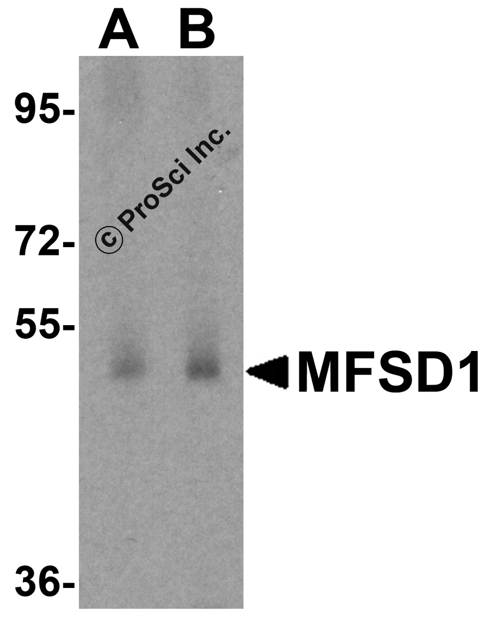 Western blot analysis of MFSD1 in human testis tissue lysate with MFSD1 antibody at (A) 1 and (B) 2 &#956;g/mL.