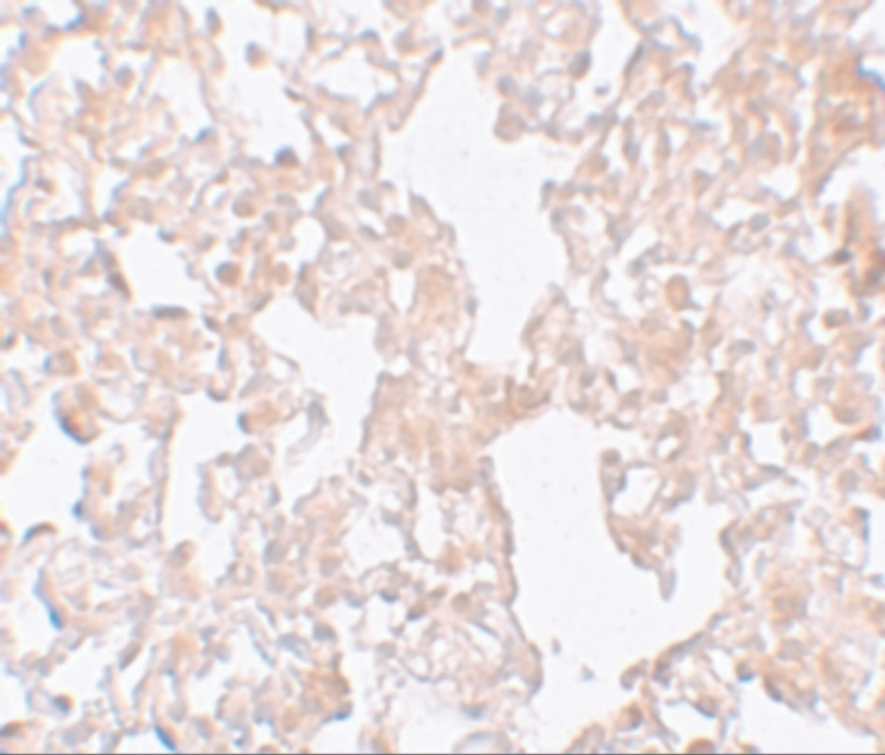 Immunohistochemistry of MFSD1 in rat lung tissue with MFSD1 antibody at 10 ug/mL.