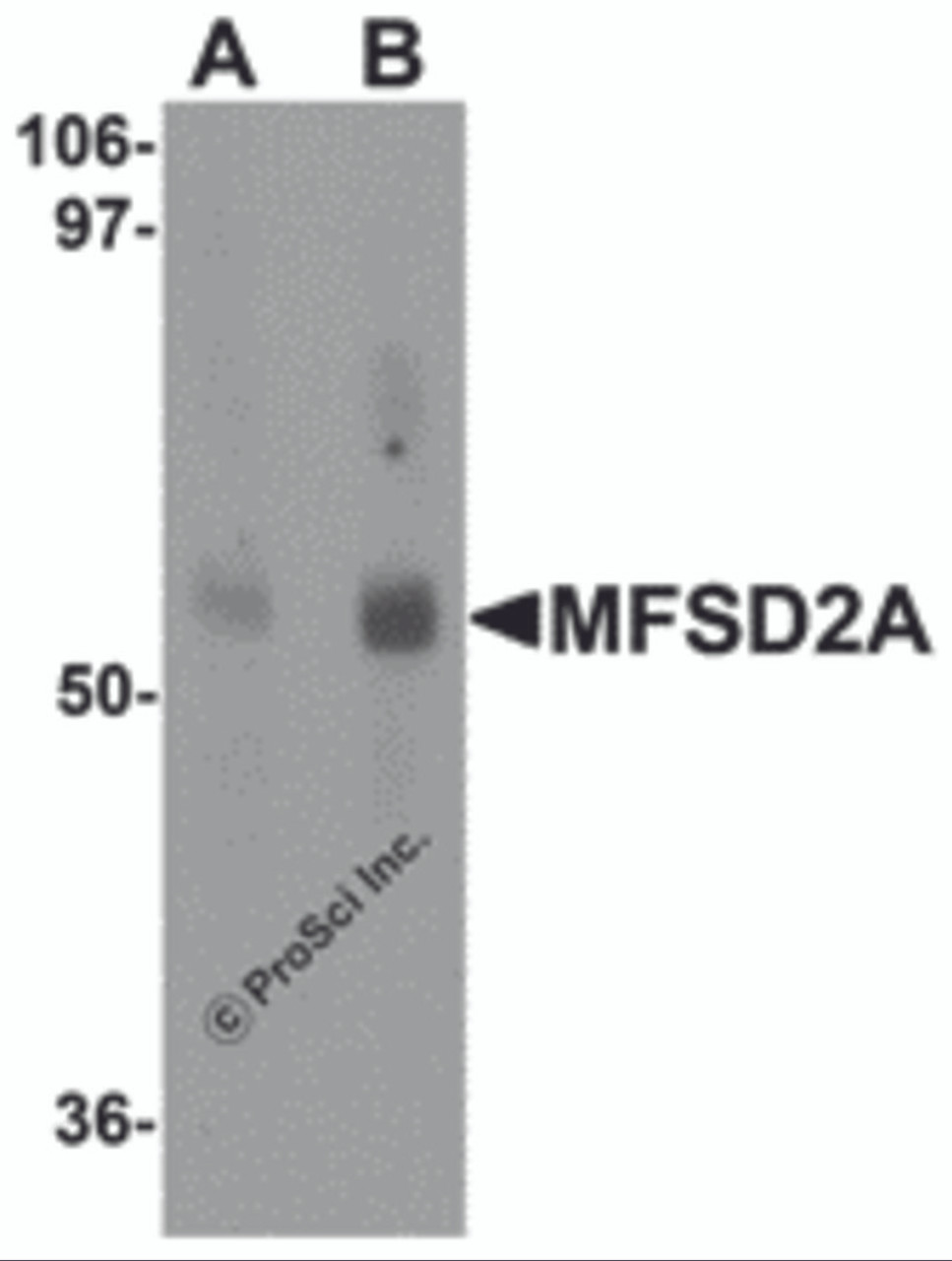 Western blot analysis of MFSD2A in rat lung tissue lysate with MFSD2A antibody at (A) 1 and (B) 2 &#956;g/mL.