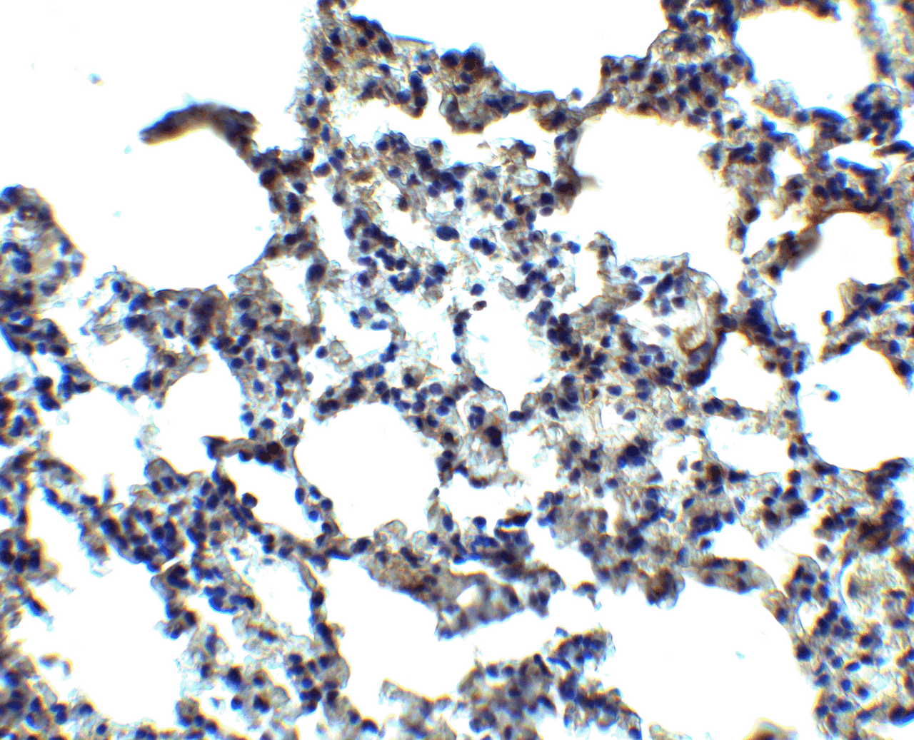 Immunohistochemistry of MFSD2A in mouse lung tissue with MFSD2A antibody at 2.5 ug/ml.