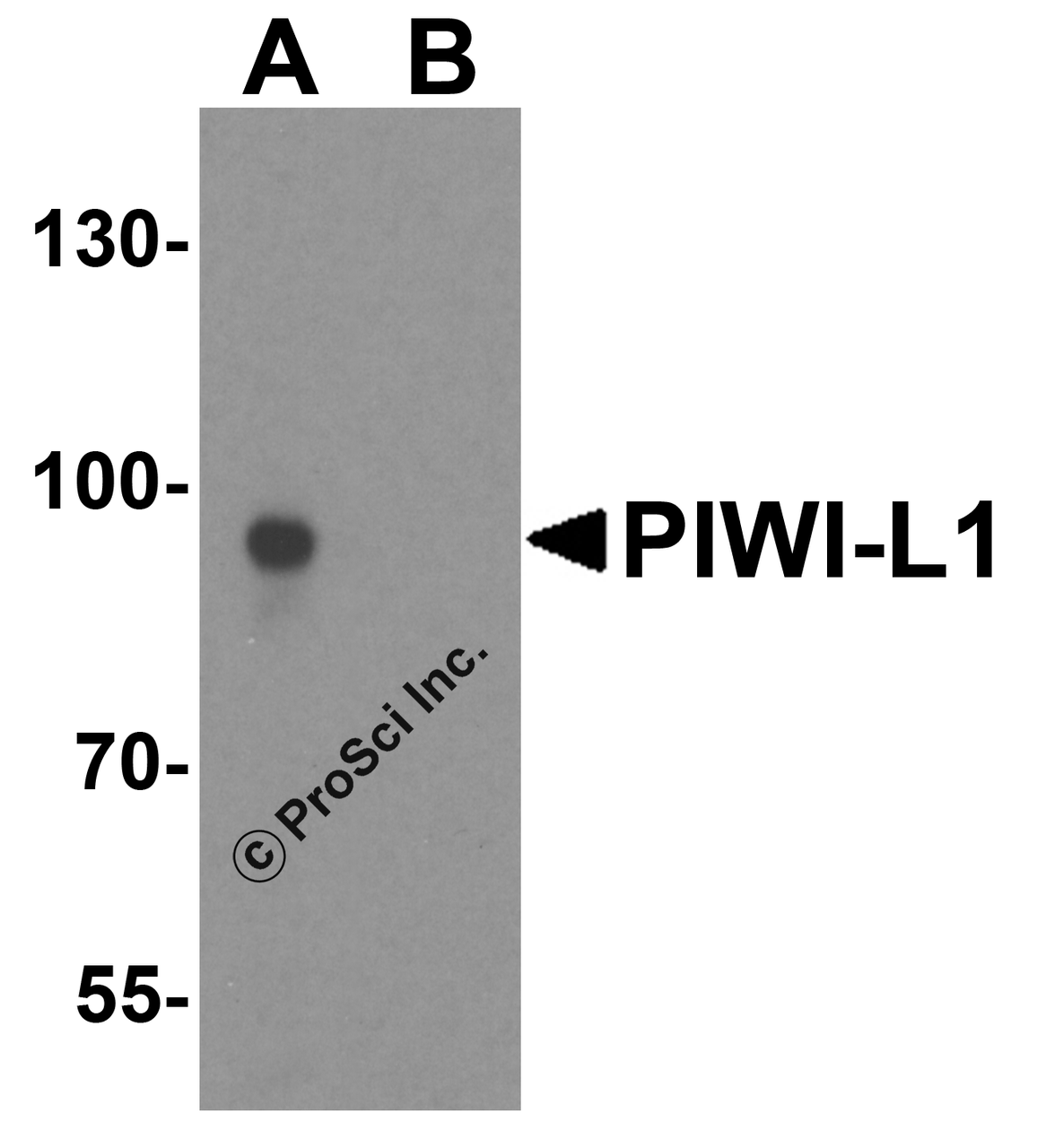 Western blot analysis of PIWI-L1 in human testis tissue lysate with PIWI-L2 antibody at 1 &#956;g/ml in (A) the absence and (B) the presence of blocking peptide.