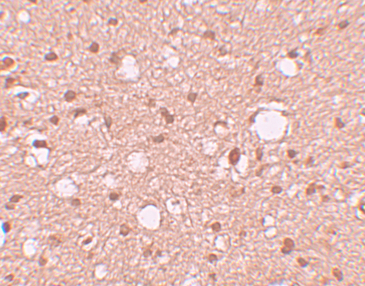 Immunohistochemistry of APBA2 in human brain tissue with APBA2 antibody at 10 ug/mL.