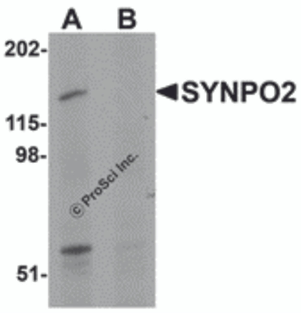 Western blot analysis of SYNPO2 in human skeletal muscle tissue lysate with SYNPO2 antibody at 1 &#956;g/mL in (A) the absence and (B) the presence of blocking peptide.