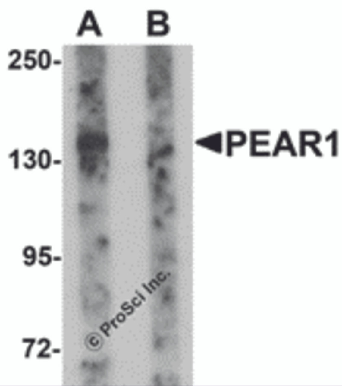 Western blot analysis of PEAR1 in rat kidney tissue lysate with PEAR1 antibody at 1 &#956;g/mL in (A) the absence and (B) the presence of blocking peptide.