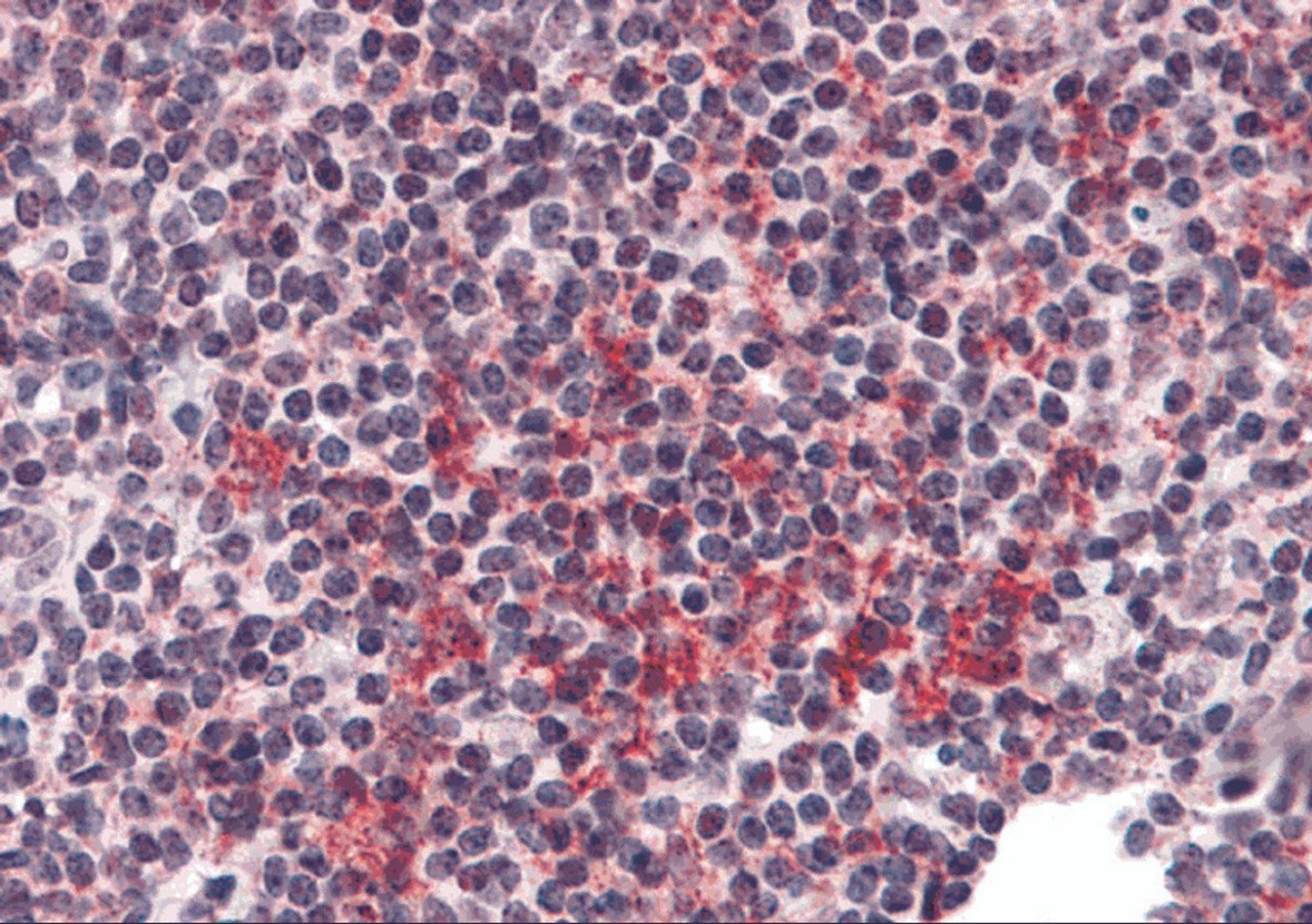 Immunohistochemistry of ZNF687 in human tonsil tissue with ZNF687 antibody at 5 &#956;g/mL.