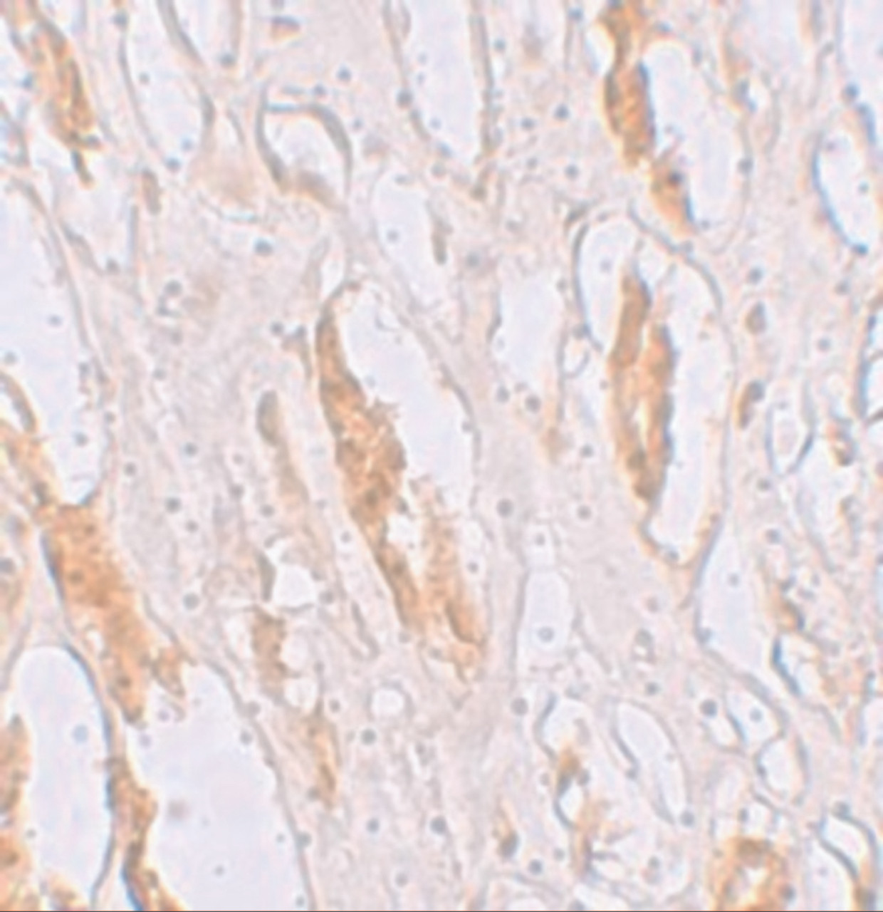 Immunohistochemistry of ZIP1 in human kidney tissue with ZIP1 antibody at 2.5 ug/mL.