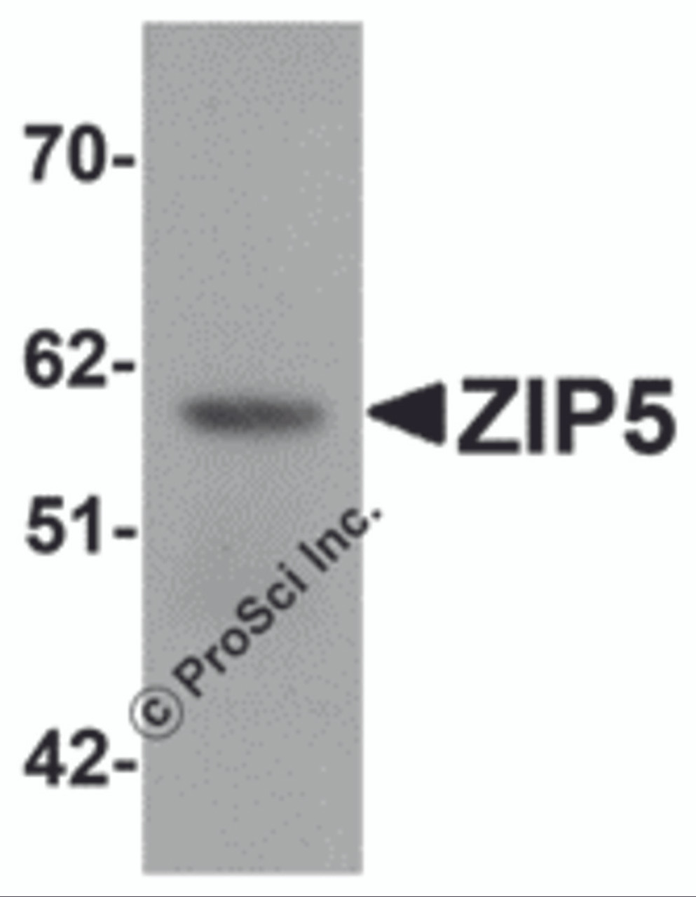 Western blot analysis of ZIP5 in human spleen tissue lysate with ZIP5 antibody at 1 &#956;g/mL.