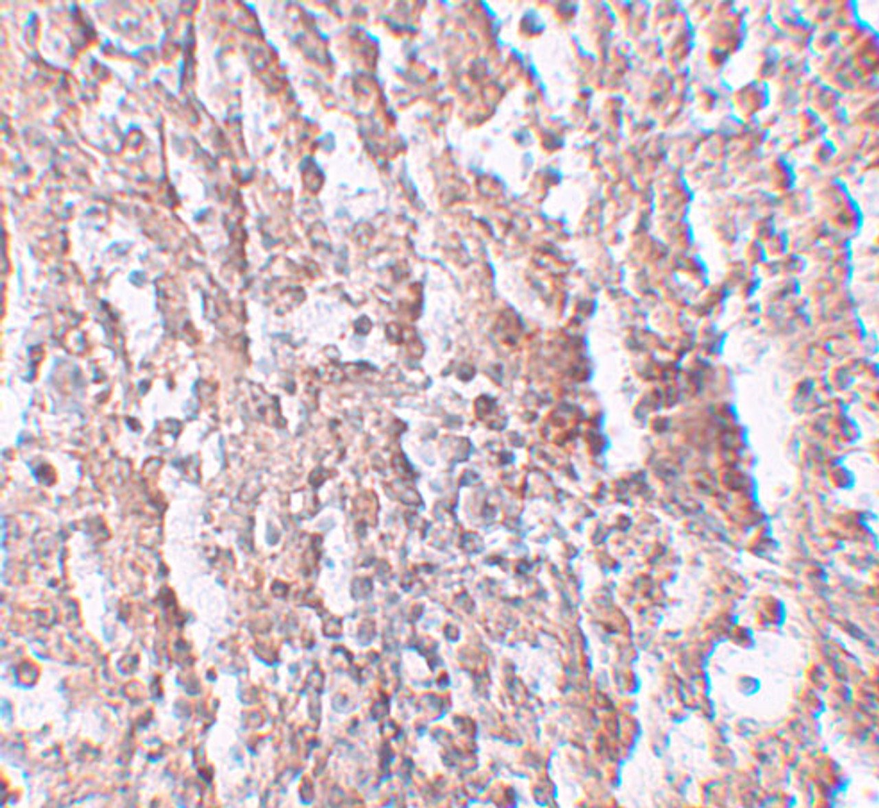 Immunohistochemistry of ZIP5 in human spleen tissue with ZIP5 antibody at 2.5 ug/mL.