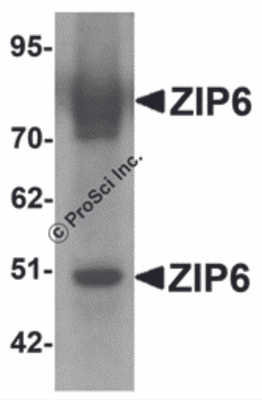 Western blot analysis of ZIP6 in mouse lung tissue lysate with ZIP6 antibody at 1 &#956;g/mL.