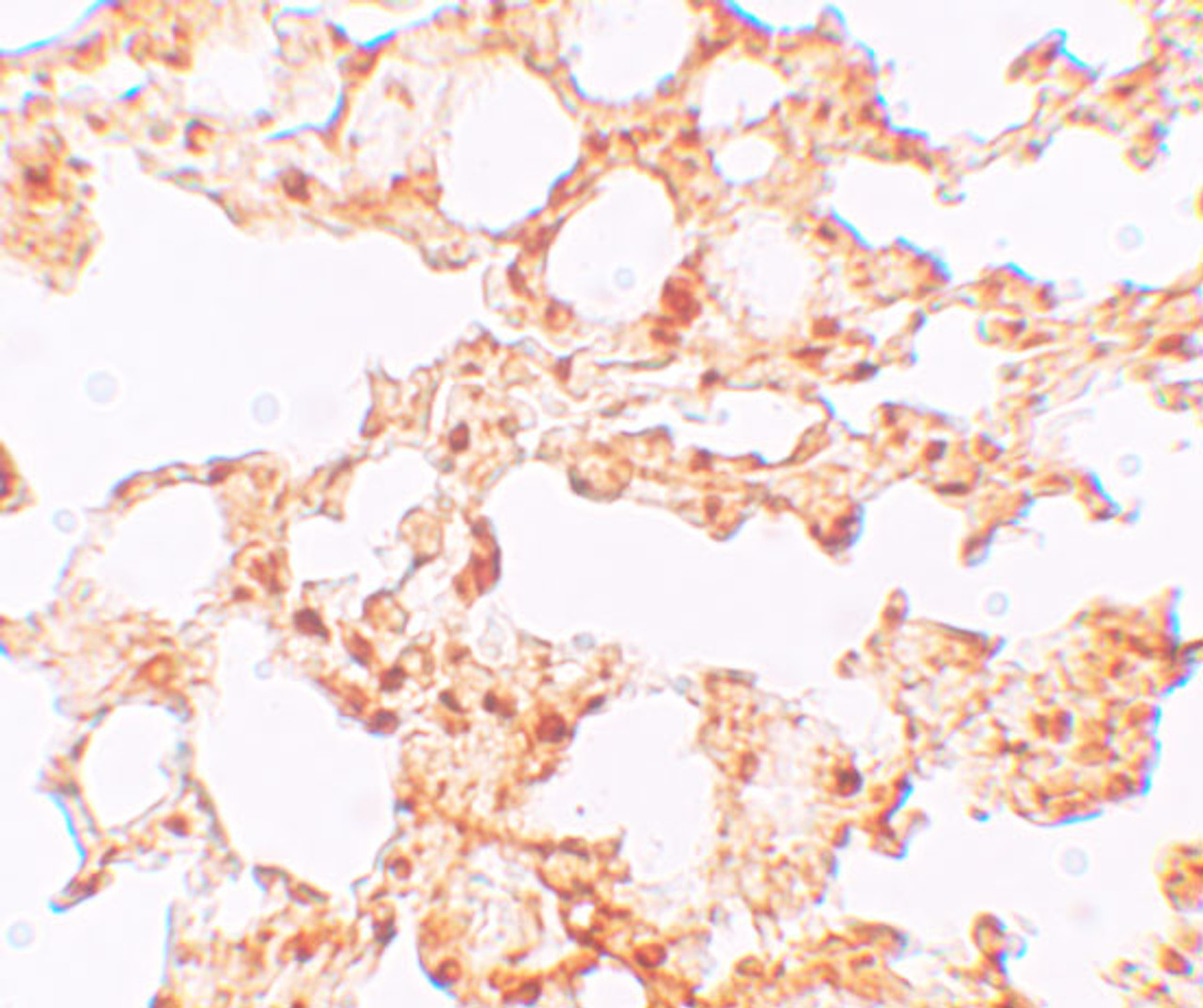 Immunohistochemistry of ZIP6 in mouse lung tissue with ZIP6 antibody at 5 ug/mL.