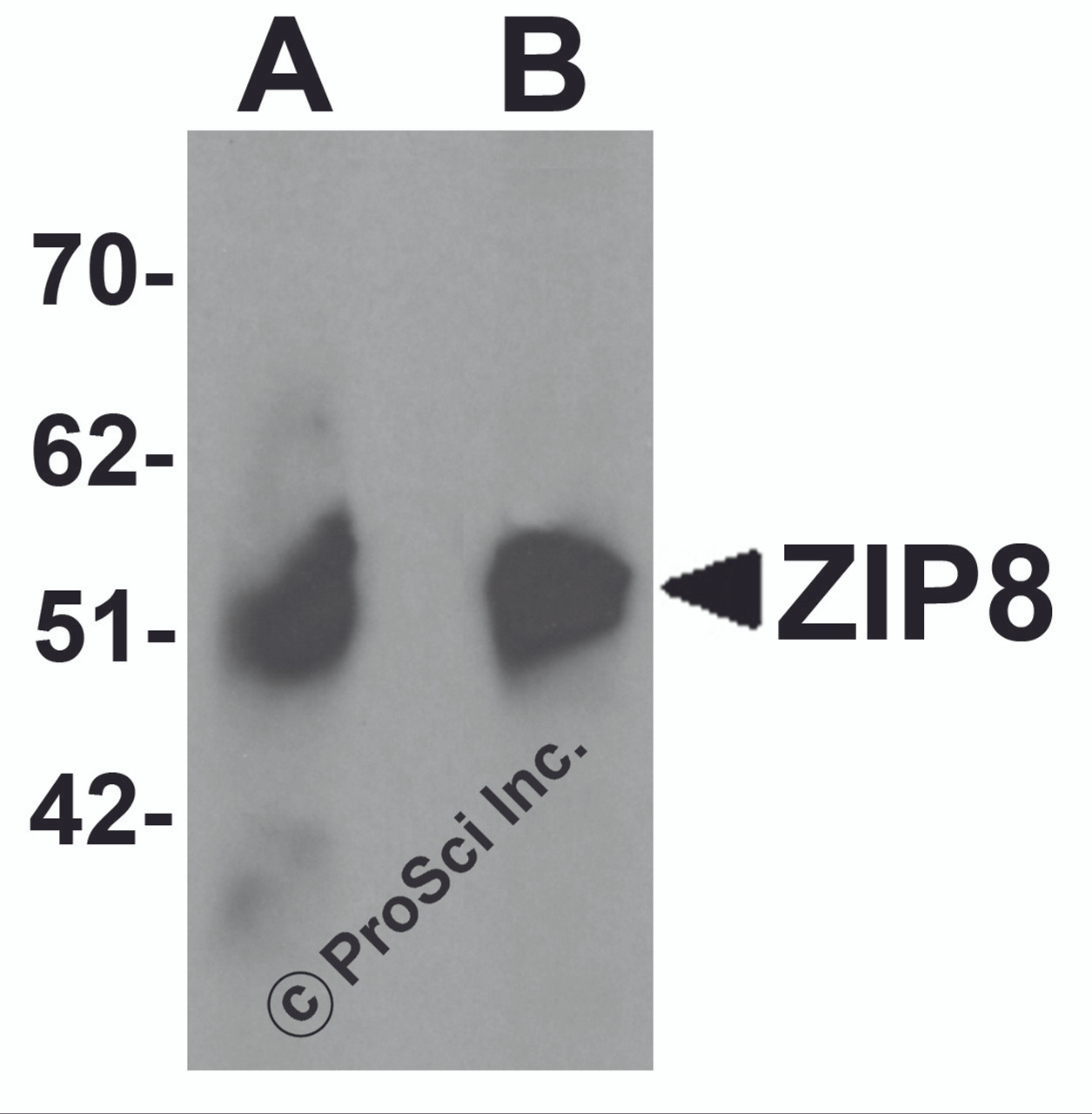 Western blot analysis of ZIP8 in human spleen tissue lysate with ZIP8 antibody at (A) 1 and (B) 2 &#956;g/mL.