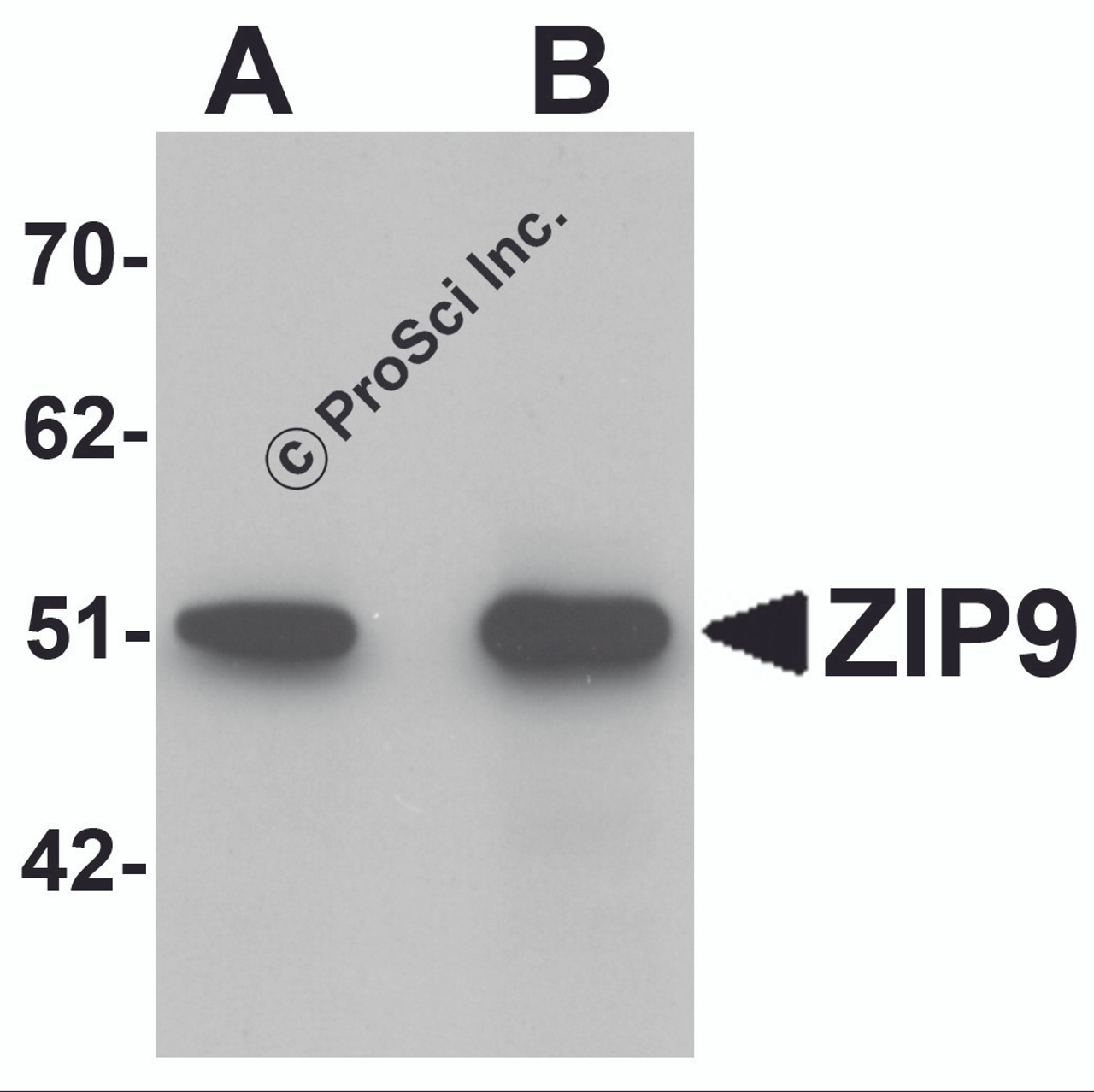 Western blot analysis of ZIP9 in HepG2 cell lysate with ZIP9 antibody at (A) 1 and (B) 2 &#956;g/mL.