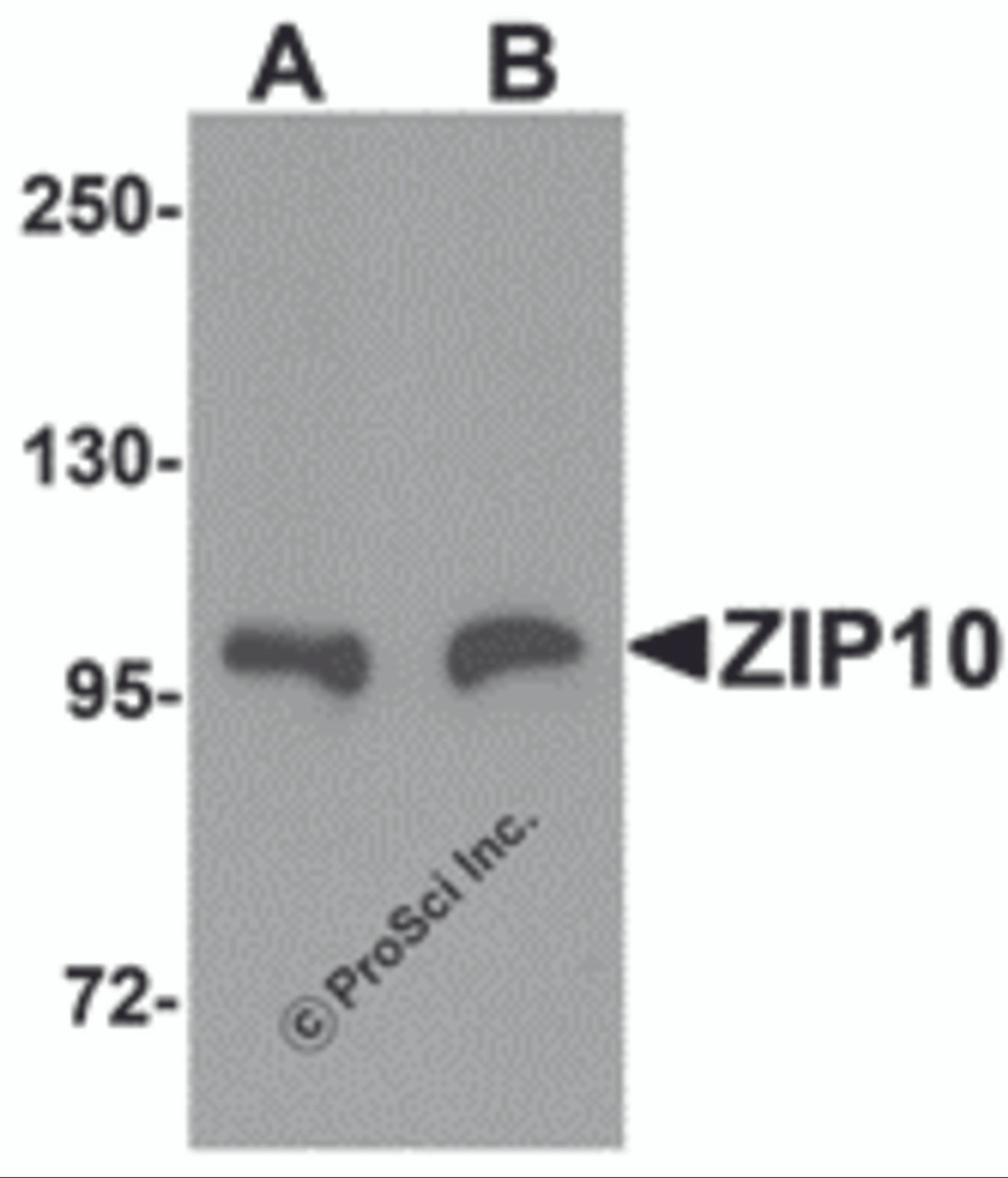 Western blot analysis of ZIP10 in human spleen tissue lysate with ZIP10 antibody at (A) 1 and (B) 2 &#956;g/mL.
