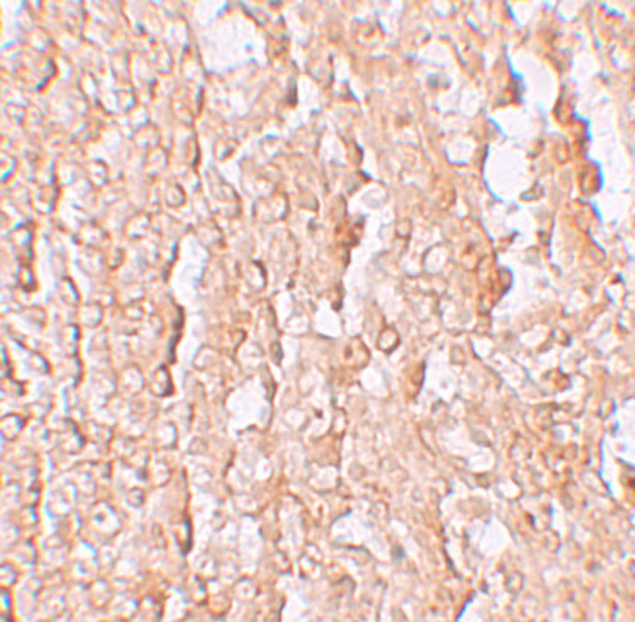 Immunohistochemistry of ZIP10 in human spleen tissue with ZIP10 antibody at 2.5 ug/mL.