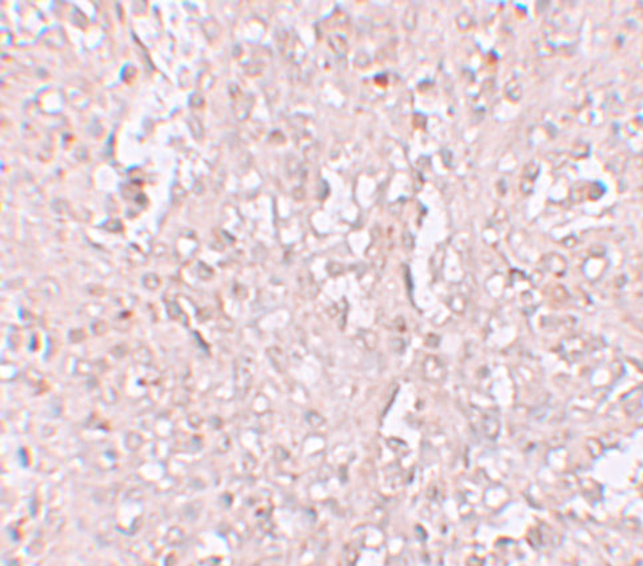 Immunohistochemistry of ZIP13 in human spleen tissue with ZIP13 antibody at 2.5 &#956;g/mL.
