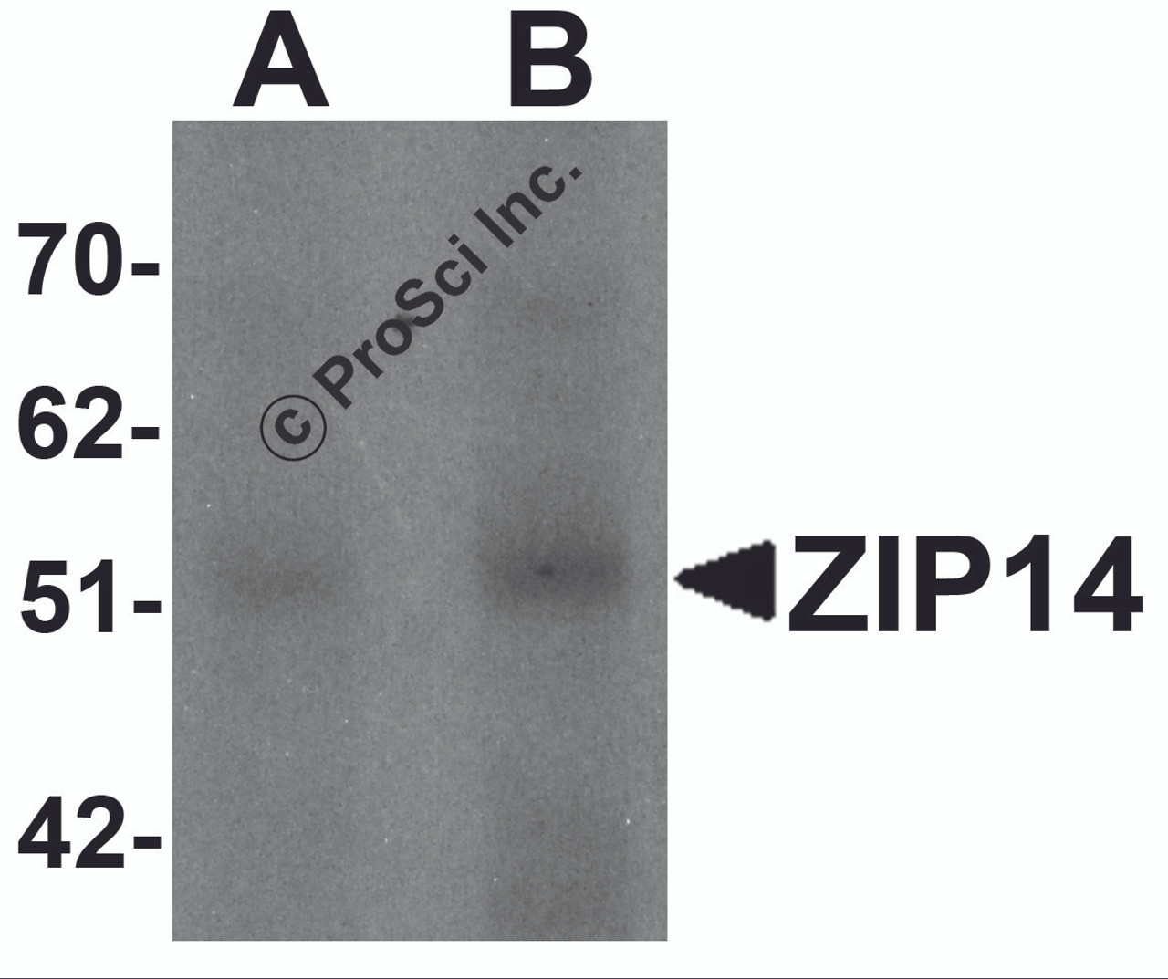 Western blot analysis of ZIP14 in human spleen tissue lysate with ZIP14 antibody at (A) 1 and (B) 2 &#956;g/mL.