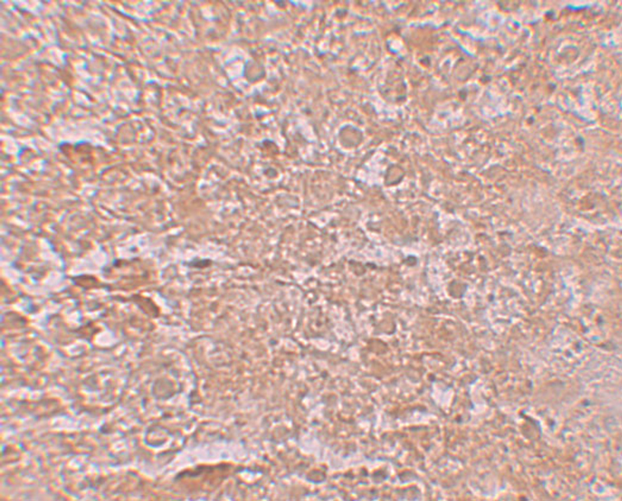 Immunohistochemistry of ZIP14 in mouse liver tissue with ZIP14 antibody at 2.5 ug/mL.