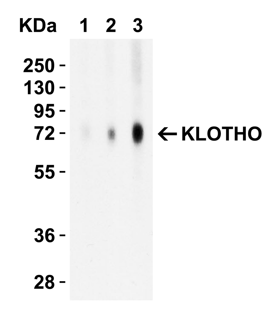 Figure 2 Western Blot Validation with Recombinant Protein
Loading: 30 ng of human KLOTHO recombinant protein per lane.
Antibodies: KLOTHO 6107 (Lane 1: 1 ug/mL, Lane 2: 2 ug/mL and Lane 3: 4 ug/mL) , 1h incubation at RT in 5% NFDM/TBST.
Secondary: Goat anti-rabbit IgG HRP conjugate at 1:10000 dilution.
Observed at around 72kD.