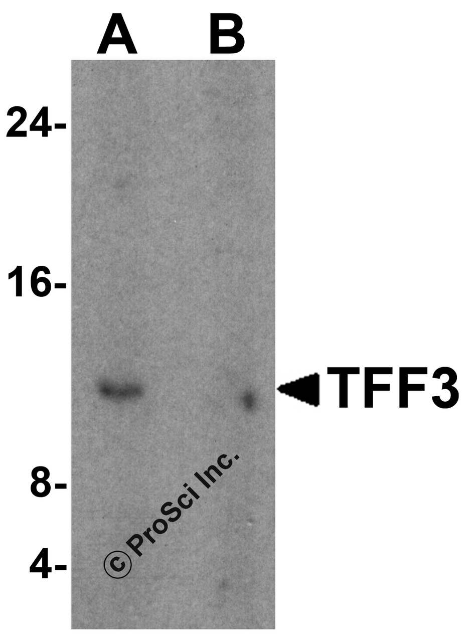 Western blot analysis of TFF3 in human colon tissue lysate with TFF3 antibody at 1 &#956;g/mL in (A) the absence and (B) the presence of blocking peptide.
