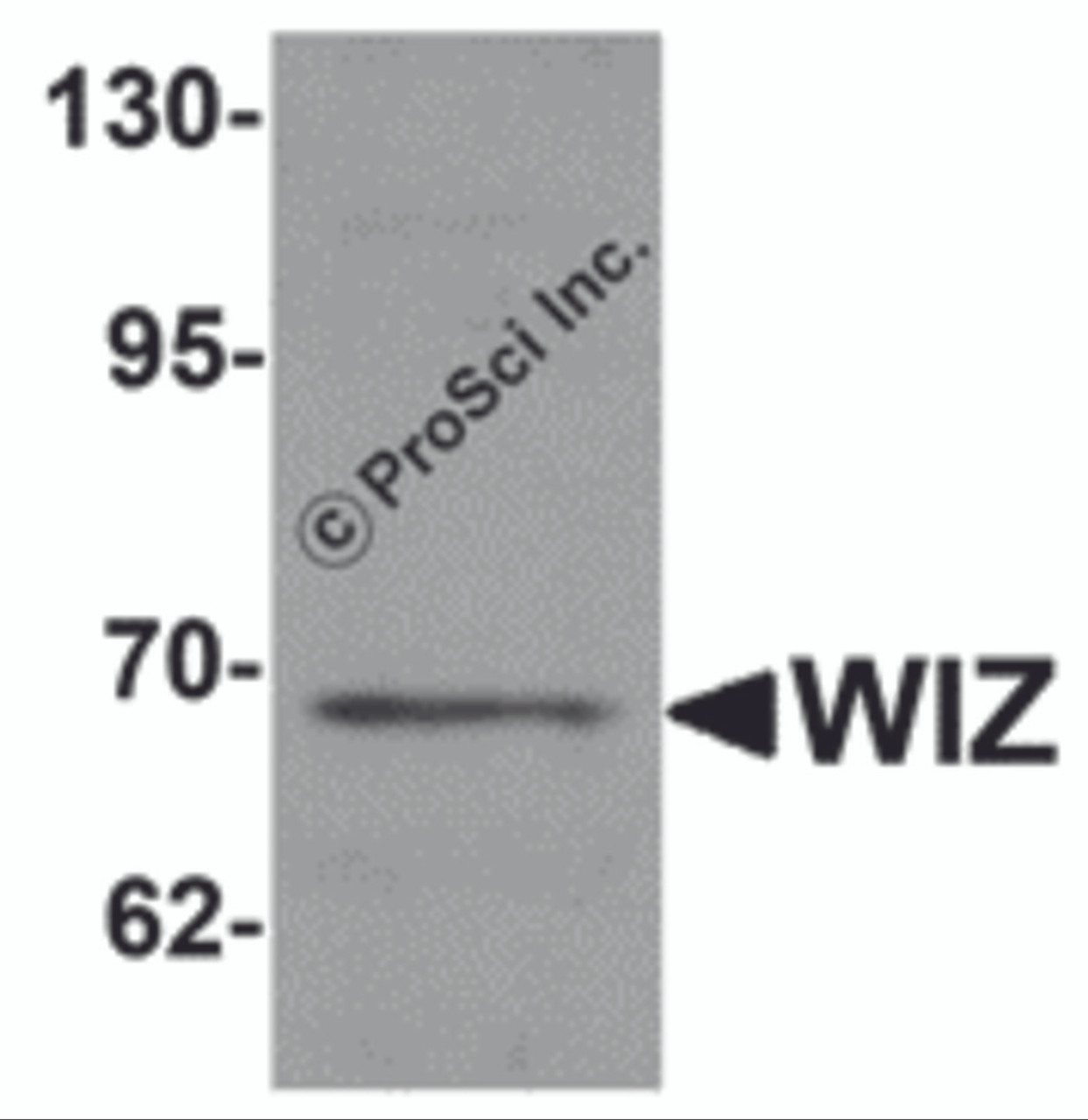 Western blot analysis of WIZ in rat lung tissue lysate with WIZ antibody at 1 &#956;g/mL.