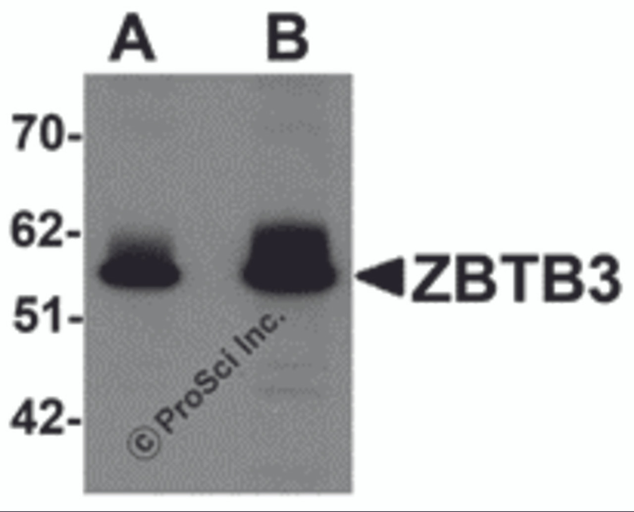 Western blot analysis of ZBTB3 in rat brain tissue lysate with ZBTB3 antibody at (A) 1 and (B) 2 &#956;g/mL.