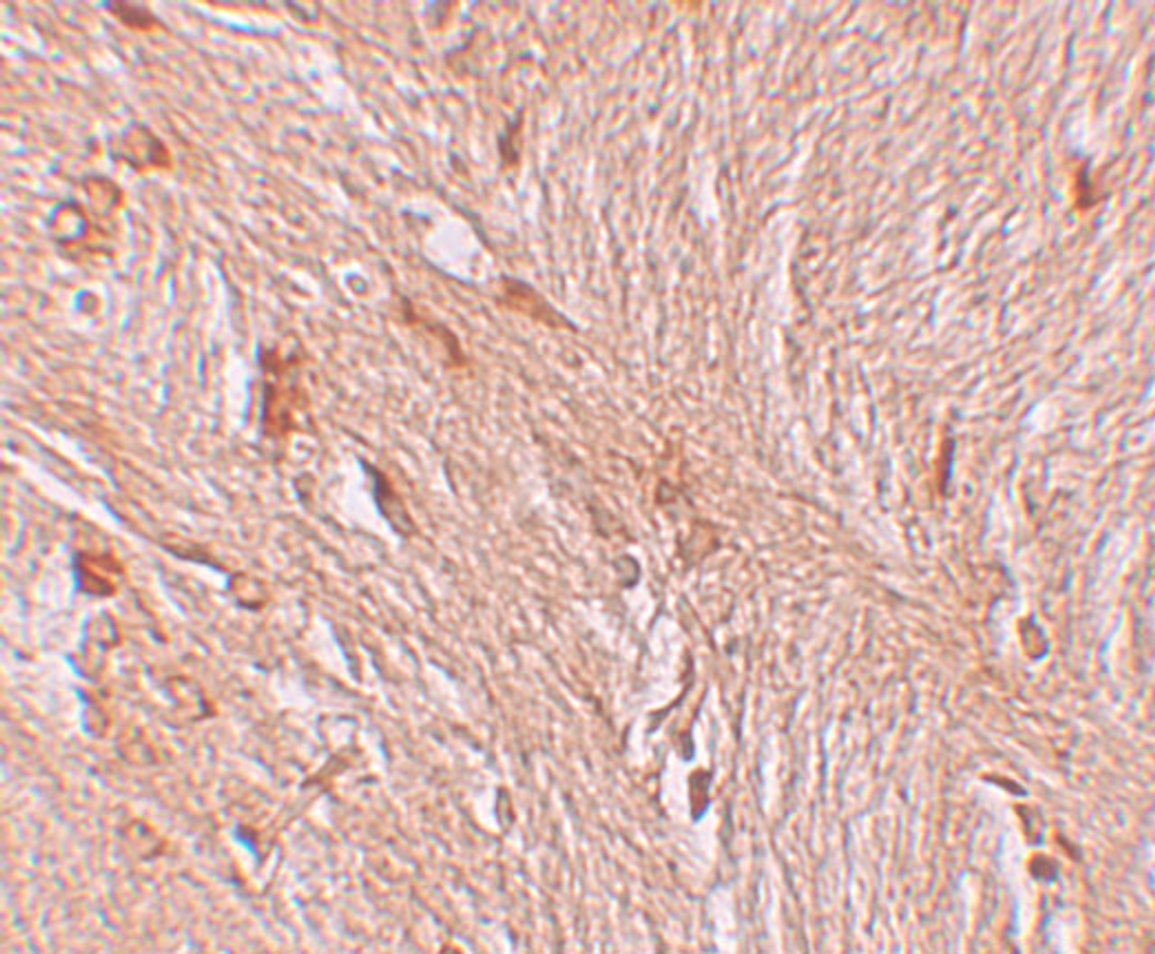 Immunohistochemistry of ZBTB3 in human brain tissue with ZBTB3 antibody at 2.5 ug/mL.